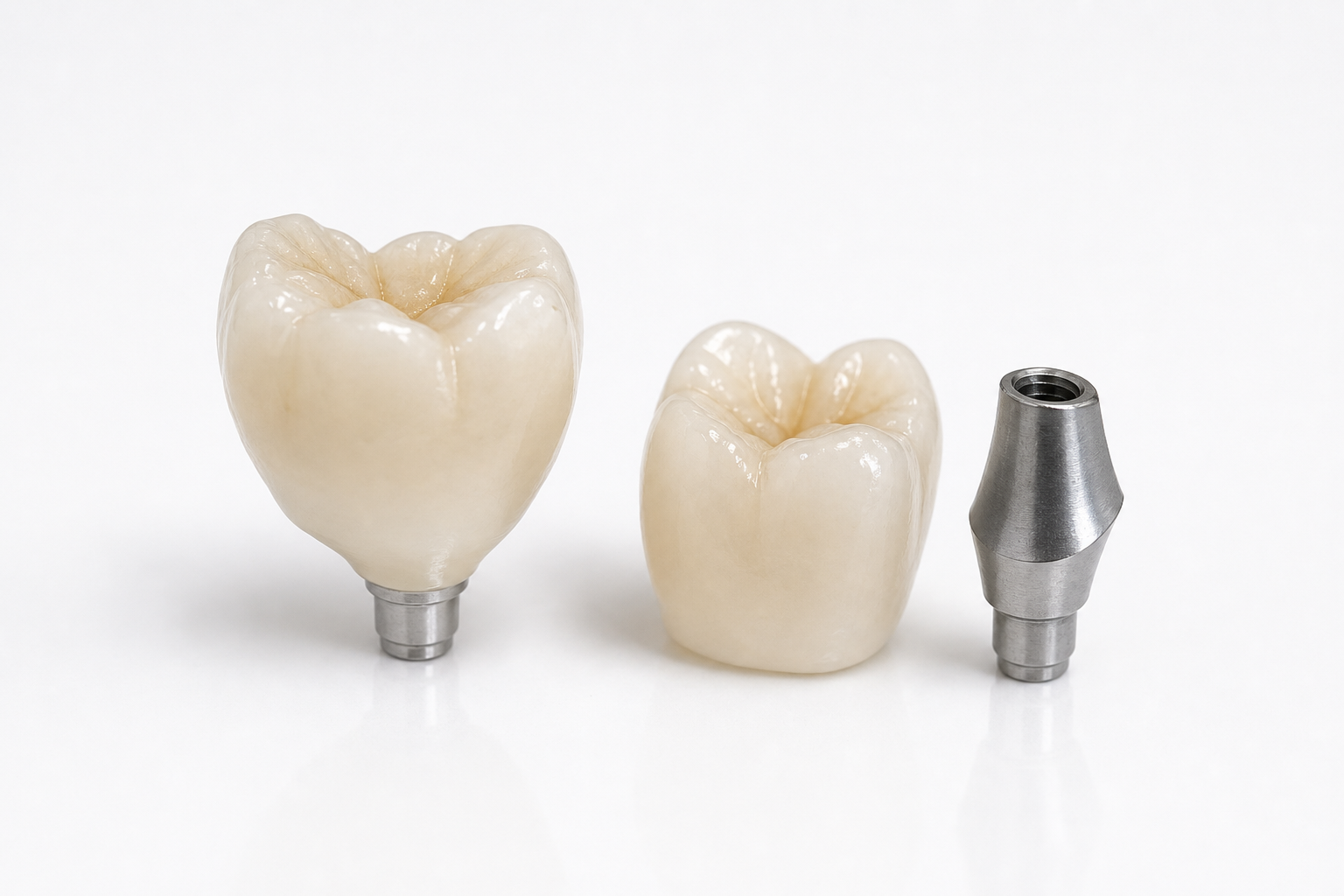 Custom implant crown on abutment