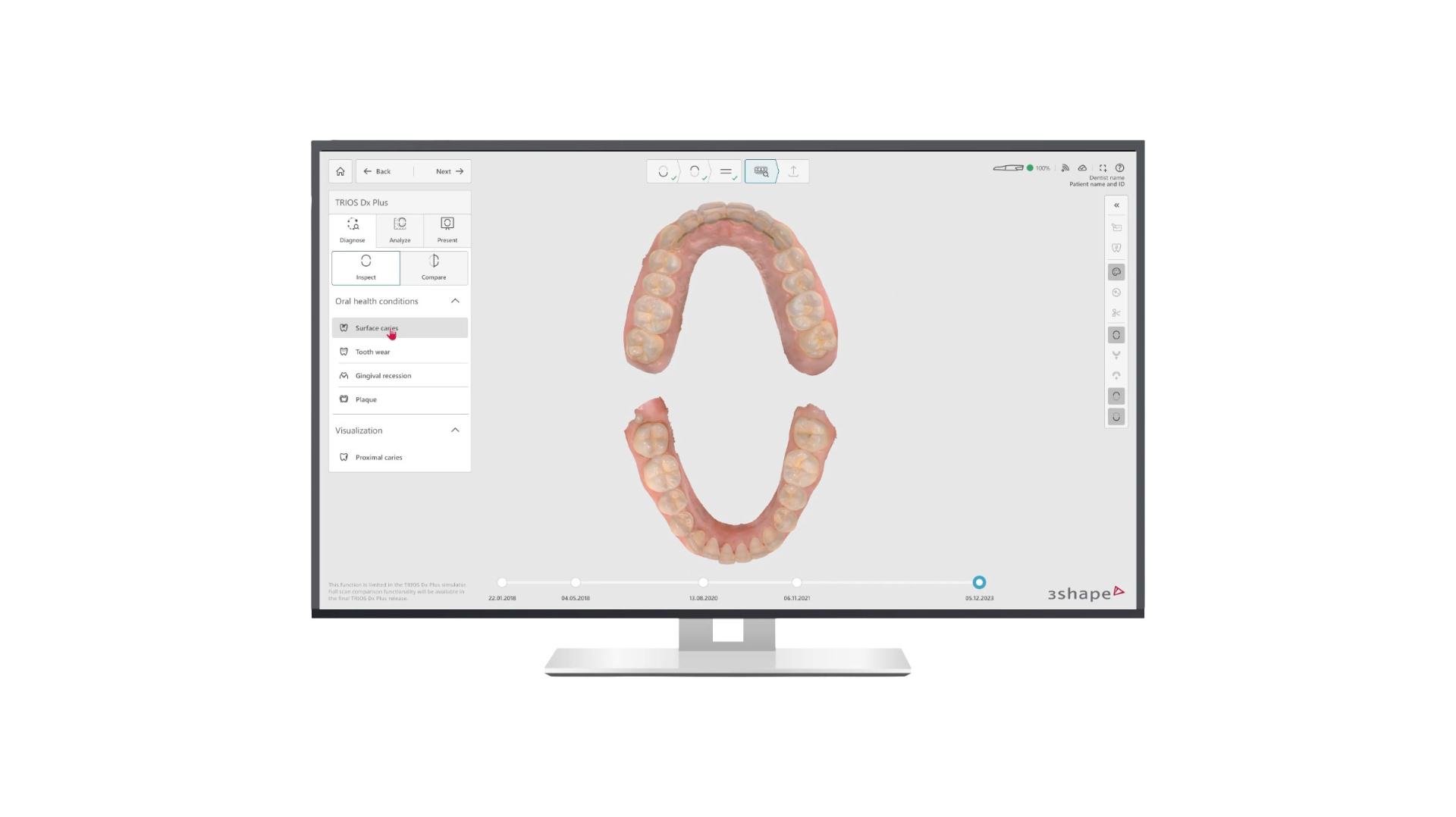 3Shape TRIOS modeless intraoral scanning interface
